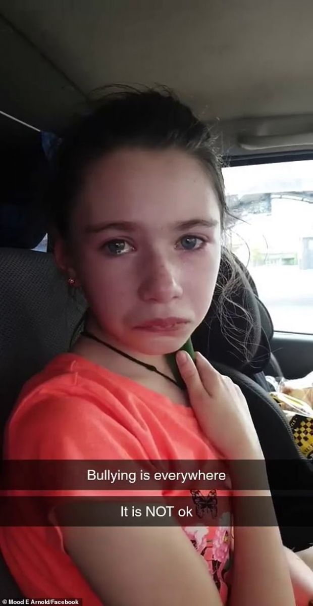 Майка показа раните от тормоз в училище над 12-годишната ѝ дъщеря с генетично заболяване (видео)